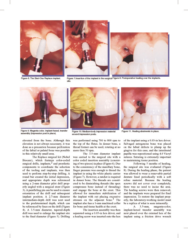 dentistry today dr. kosenski page 3