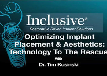 implant placement video introduction
