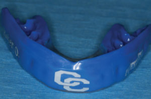 mouthguards for athletic patients