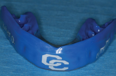 mouthguards for athletic patients