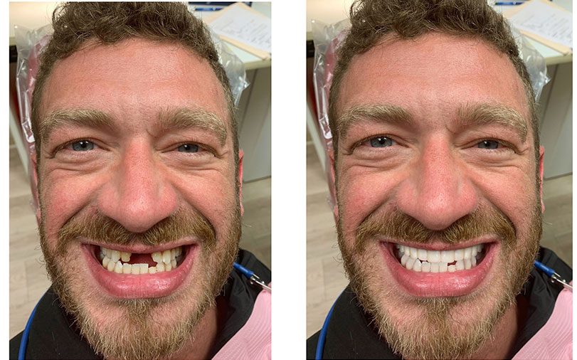 before and after