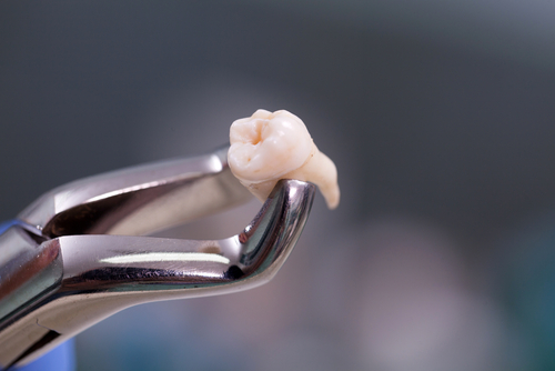 Dental,Equipment,Holding,An,Extracted,Tooth